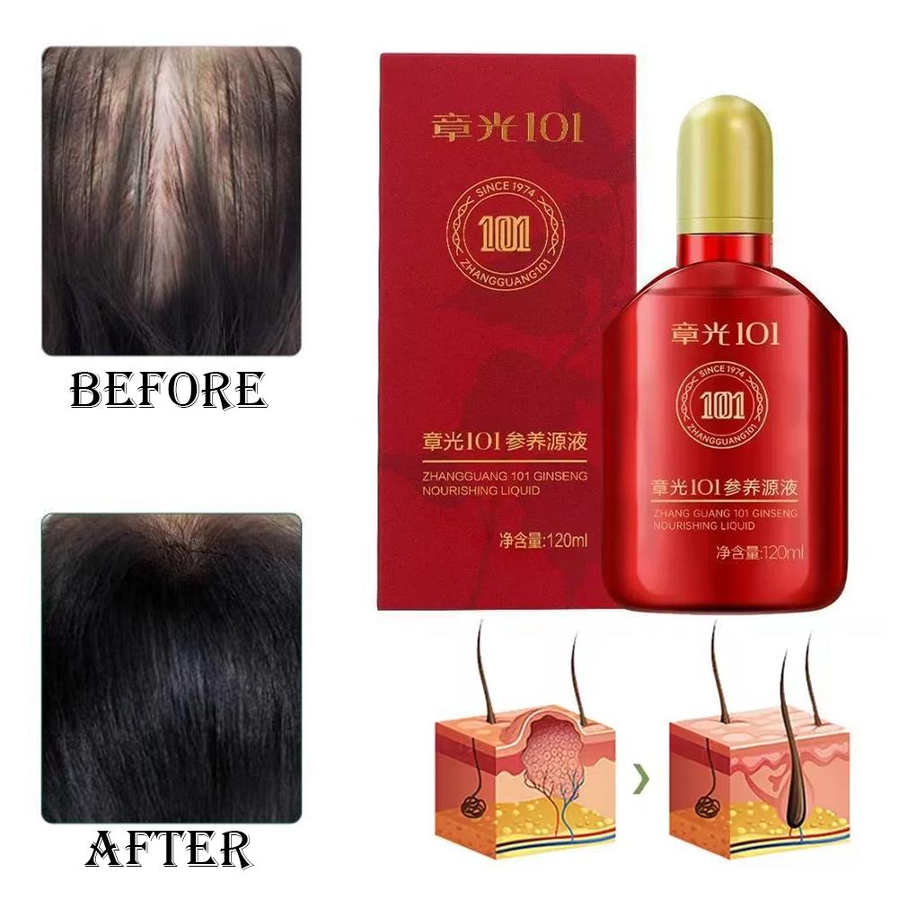 จาง กวง 101 ฟอร์มูล่า (101P) 1 - Hair Care Normal บทวิจารณ์และราคา