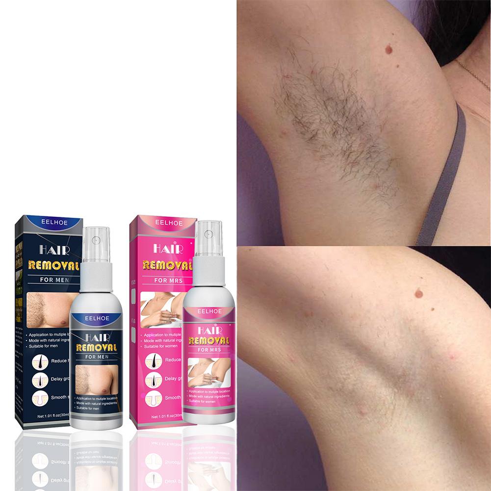 1/2PCS Super NATURAL ไม่เจ็บปว - Hair Care Women บทวิจารณ์และราคา