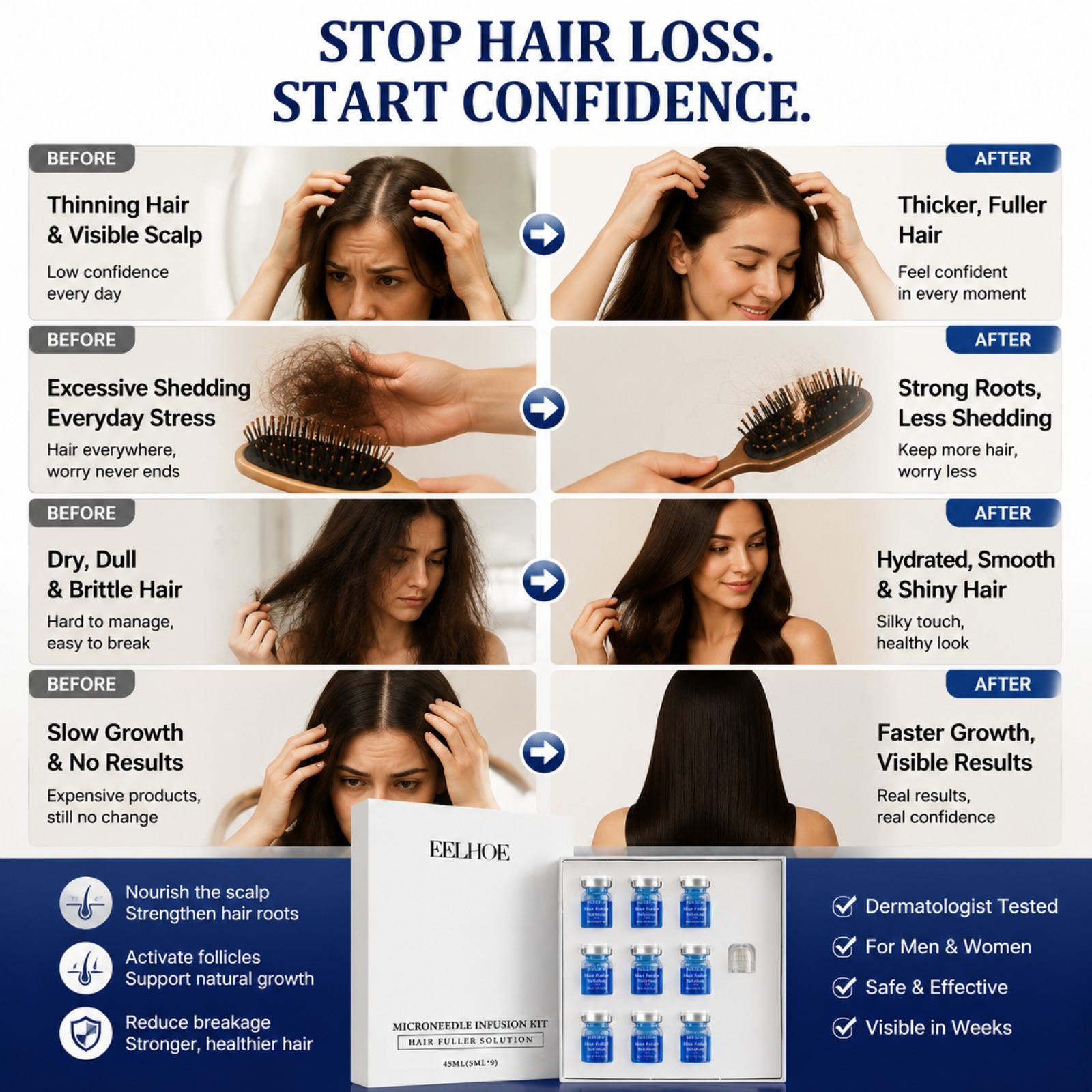 ระบบปลูกผมใหม่ด้วยไมโครนีดเดิล - Hair Care Normal บทวิจารณ์และราคา