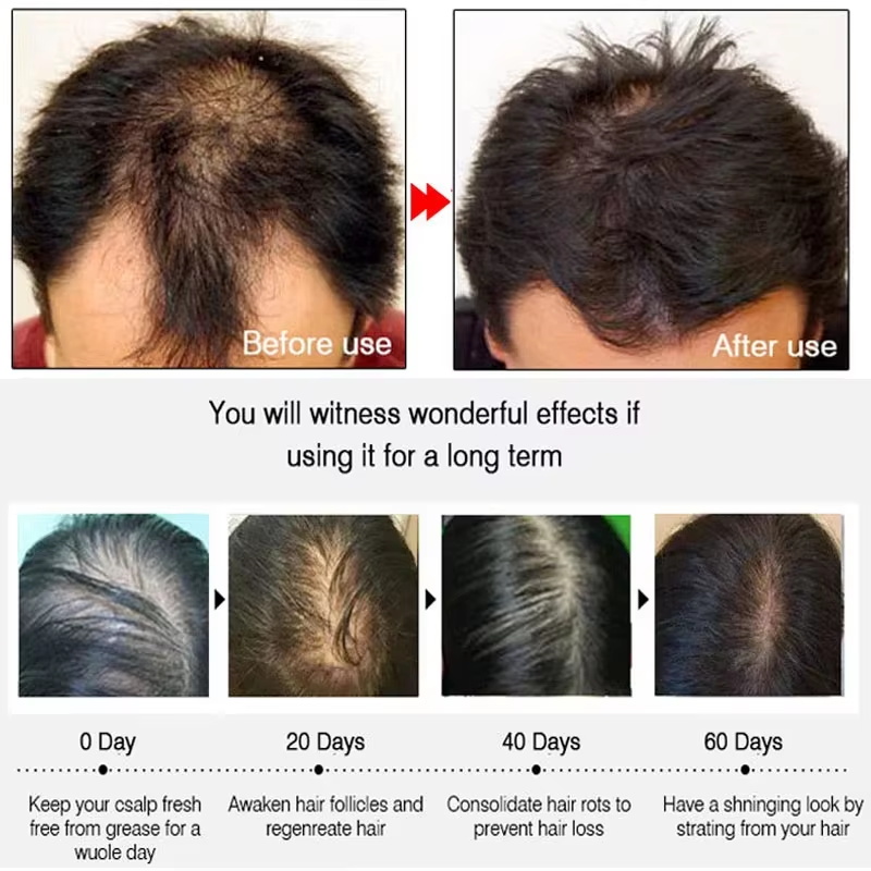สเปรย์เร่งผมยาวขึ้นอย่างรวดเร็ - Hair Care Products บทวิจารณ์และราคา